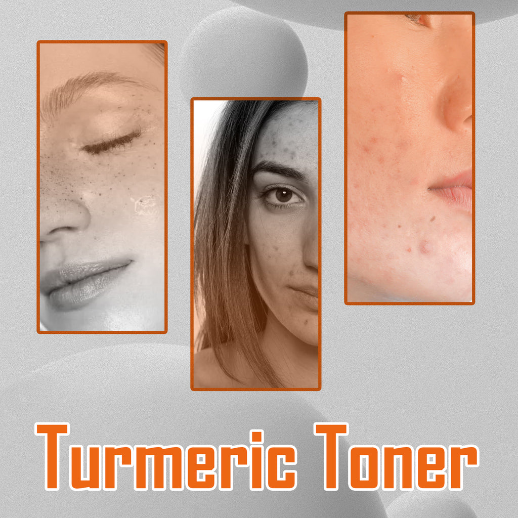 Turmeric Dark Spot Eraser Toner — Brightening & Hydrating Facial Toner